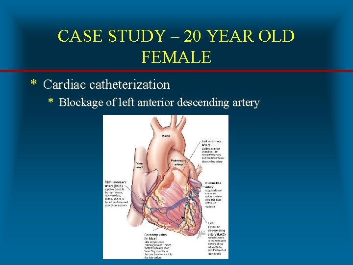 CASE STUDY – 20 YEAR OLD FEMALE * Cardiac catheterization * Blockage of left