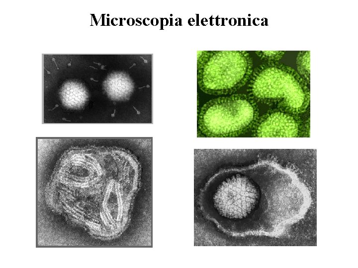 Microscopia elettronica 