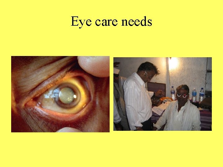 Eye care needs 