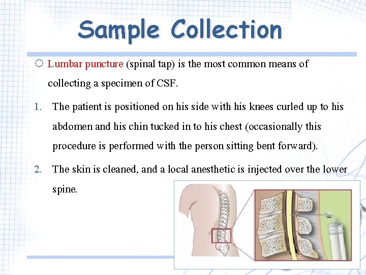 Sample Collection ◌ Lumbar puncture (spinal tap) is the most common means of collecting