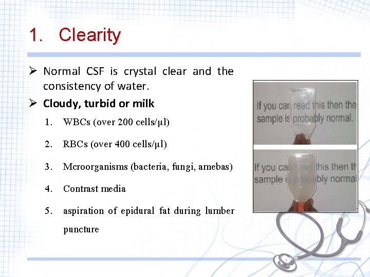 1. Clearity Ø Normal CSF is crystal clear and the consistency of water. Ø 1. Clearity Ø Normal CSF is crystal clear and the consistency of water. Ø