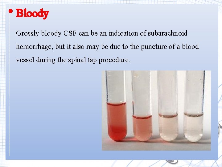 • Bloody Grossly bloody CSF can be an indication of subarachnoid hemorrhage, but • Bloody Grossly bloody CSF can be an indication of subarachnoid hemorrhage, but