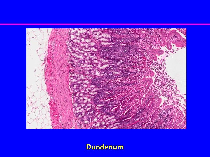 Duodenum 