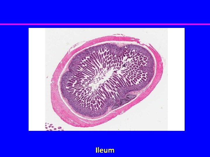 Ileum 