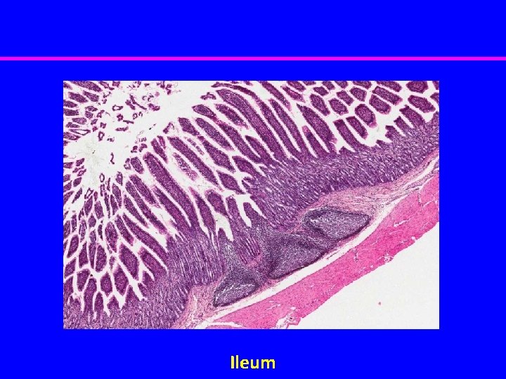 Ileum 