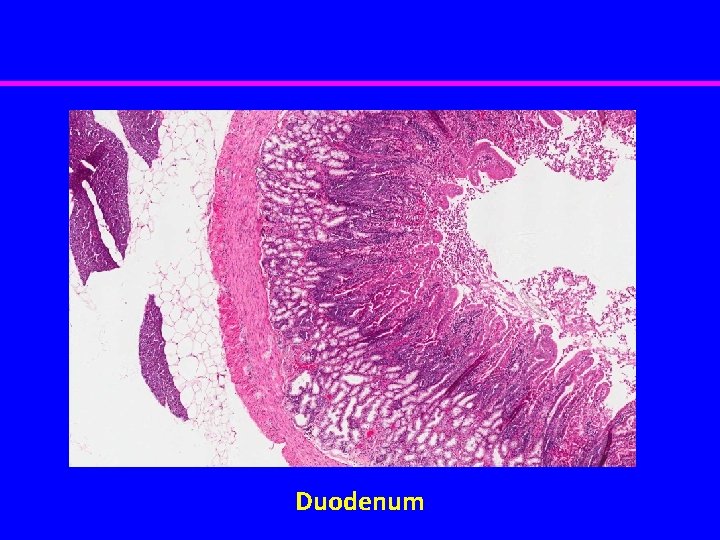 Duodenum 