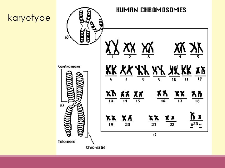 karyotype 