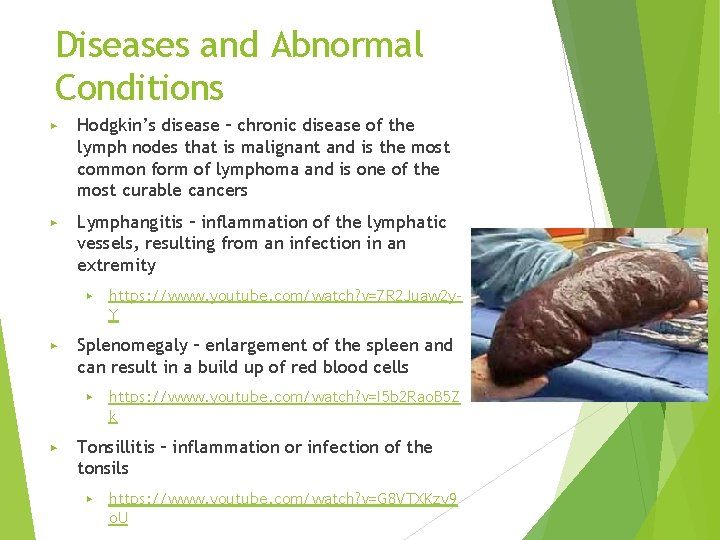 Diseases and Abnormal Conditions ▶ Hodgkin’s disease – chronic disease of the lymph nodes