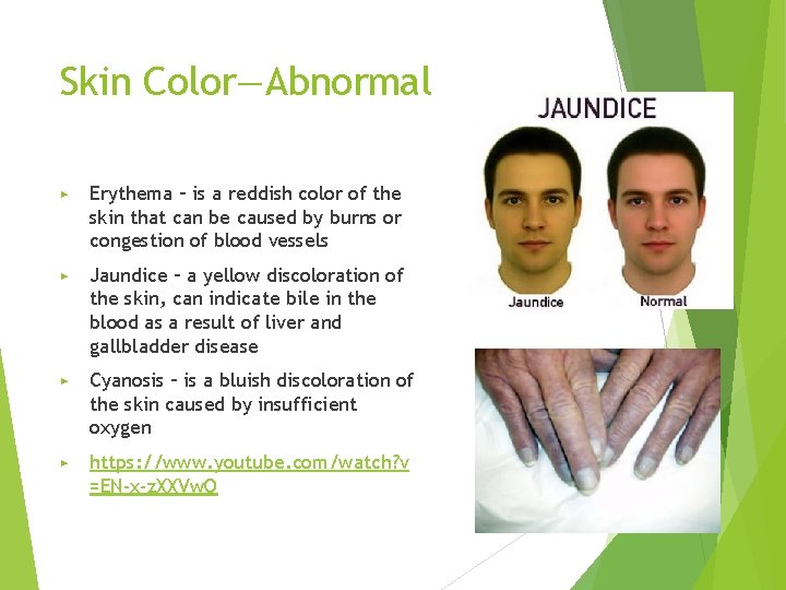 Skin Color—Abnormal ▶ Erythema – is a reddish color of the skin that can