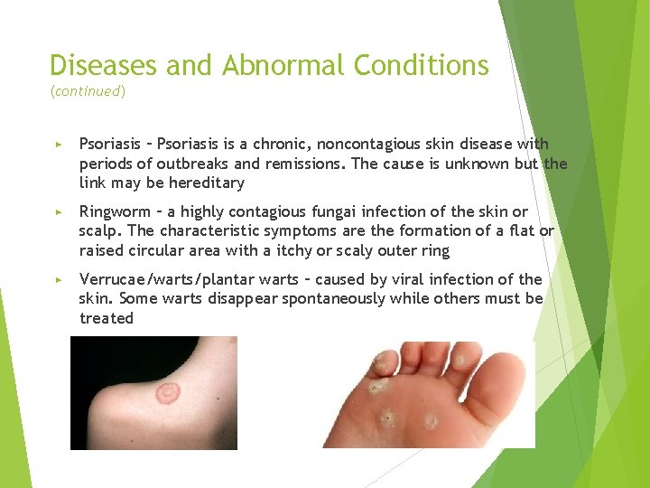 Diseases and Abnormal Conditions (continued) ▶ Psoriasis – Psoriasis is a chronic, noncontagious skin