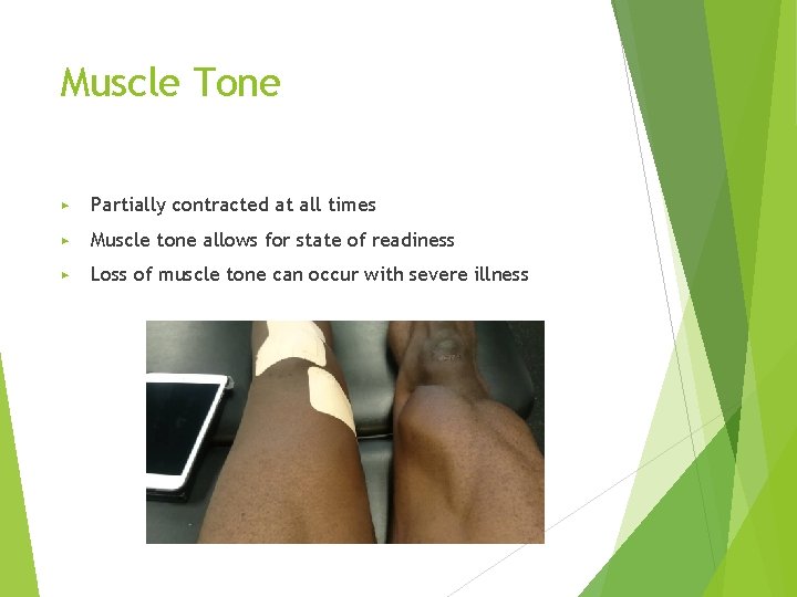 Muscle Tone ▶ Partially contracted at all times ▶ Muscle tone allows for state
