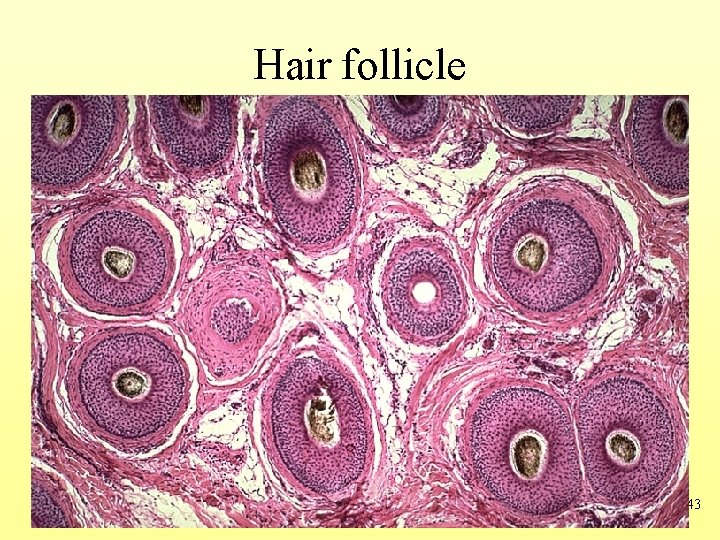 Hair follicle 5 -43 