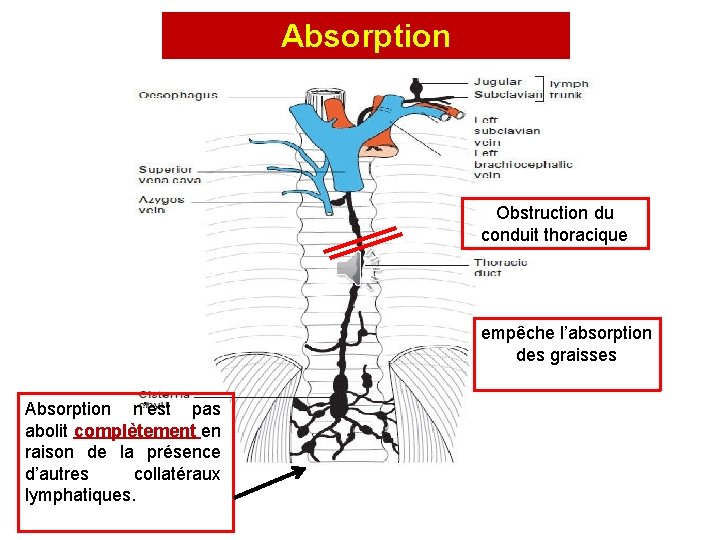 Absorption Obstruction du conduit thoracique empêche l’absorption des graisses Absorption n’est pas abolit complètement