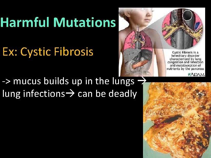 Harmful Mutations Ex: Cystic Fibrosis -> mucus builds up in the lungs lung infections