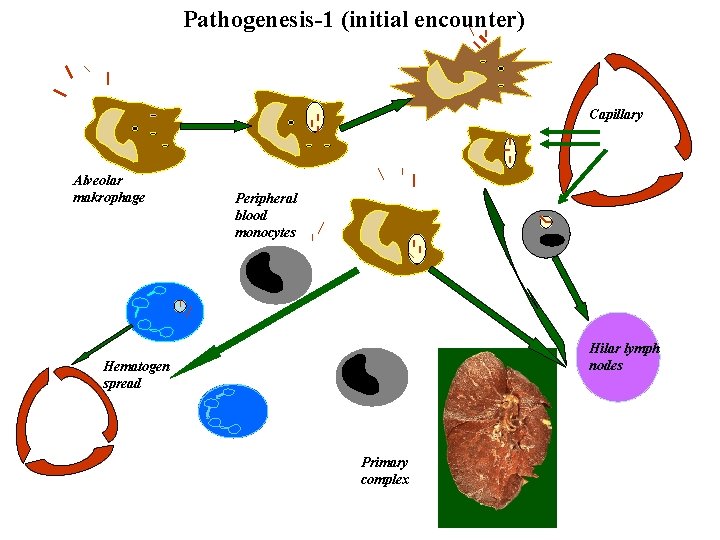 Pathogenesis-1 (initial encounter) Capillary Alveolar makrophage Peripheral blood monocytes Hilar lymph nodes Hematogen spread