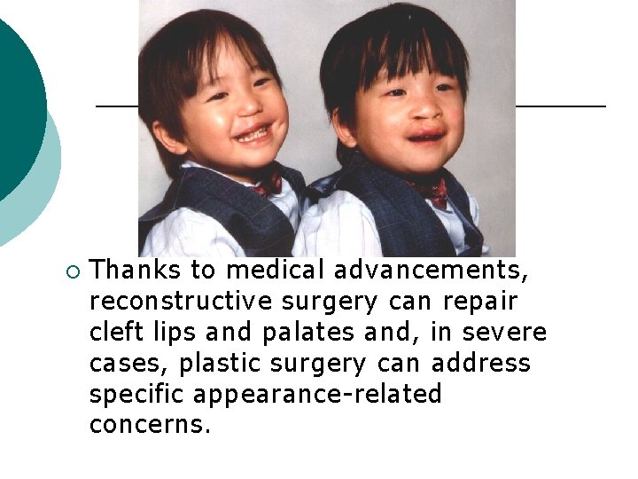 ¡ Thanks to medical advancements, reconstructive surgery can repair cleft lips and palates and,