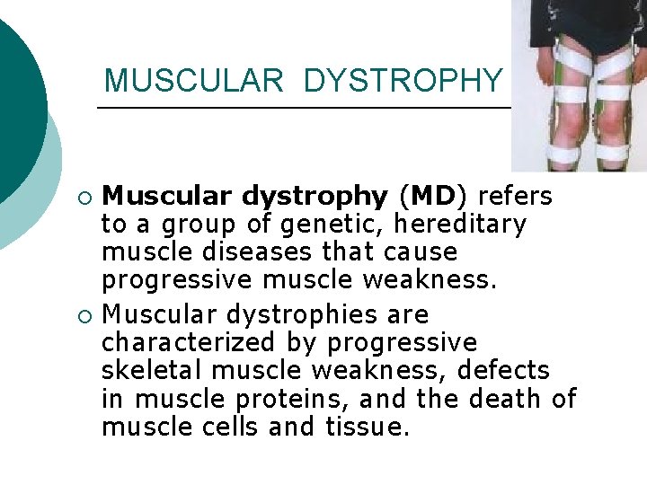 MUSCULAR DYSTROPHY Muscular dystrophy (MD) refers to a group of genetic, hereditary muscle diseases