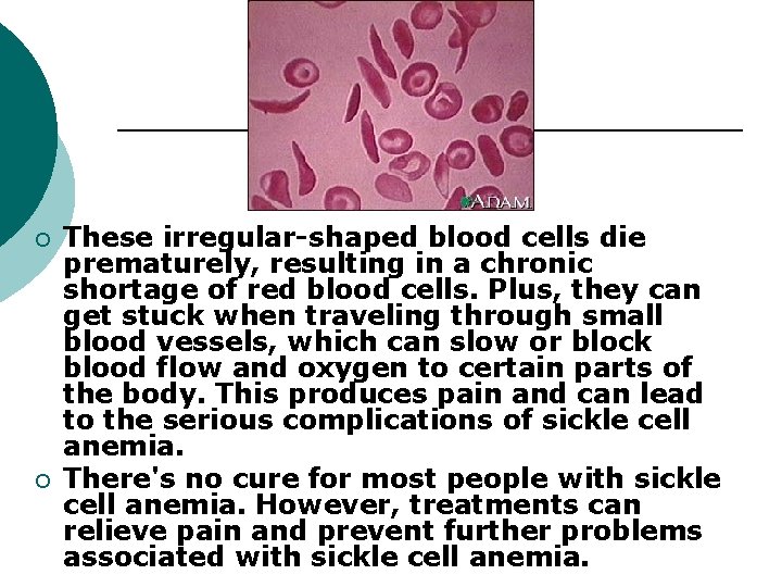 ¡ ¡ These irregular-shaped blood cells die prematurely, resulting in a chronic shortage of