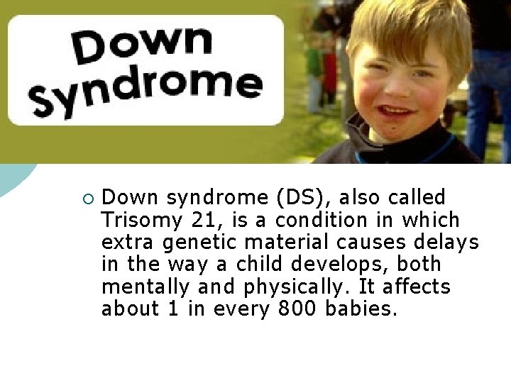 ¡ Down syndrome (DS), also called Trisomy 21, is a condition in which extra