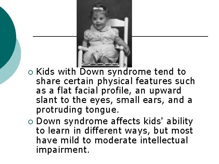 Kids with Down syndrome tend to share certain physical features such as a flat