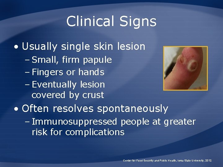 Clinical Signs • Usually single skin lesion – Small, firm papule – Fingers or