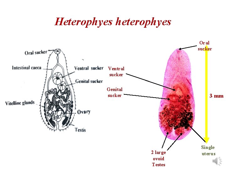 Heterophyes heterophyes Oral sucker Ventral sucker Genital sucker 3 mm 2 large ovoid Testes