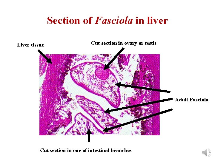 Section of Fasciola in liver Liver tissue Cut section in ovary or testis Adult