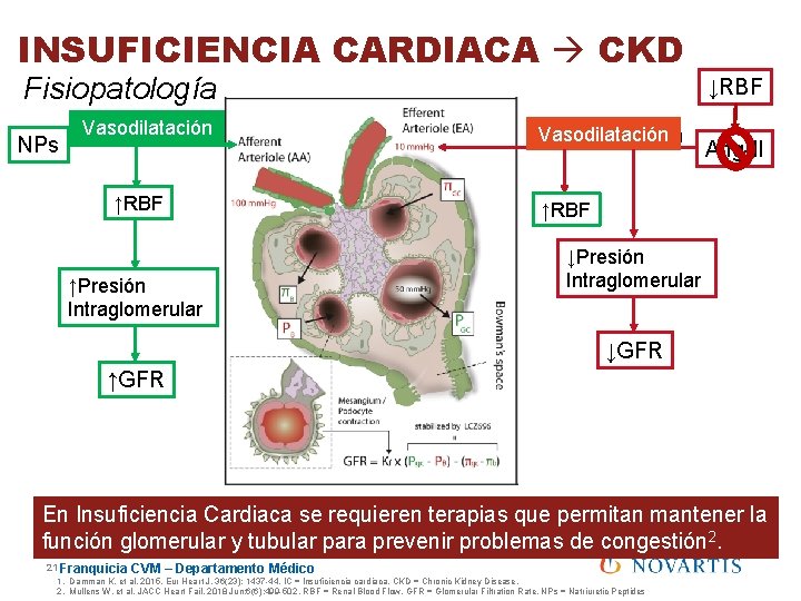 INSUFICIENCIA CARDIACA CKD Fisiopatología NPs Vasodilatación ↑RBF ↑Presión Intraglomerular ↓RBF Vasodilatación Vasoconstricción Ang-II ↑RBF