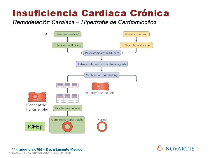 Insuficiencia Cardiaca Crónica Remodelación Cardiaca – Hipertrofia de Cardiomiocitos ICFEp 28 Franquicia CVM –