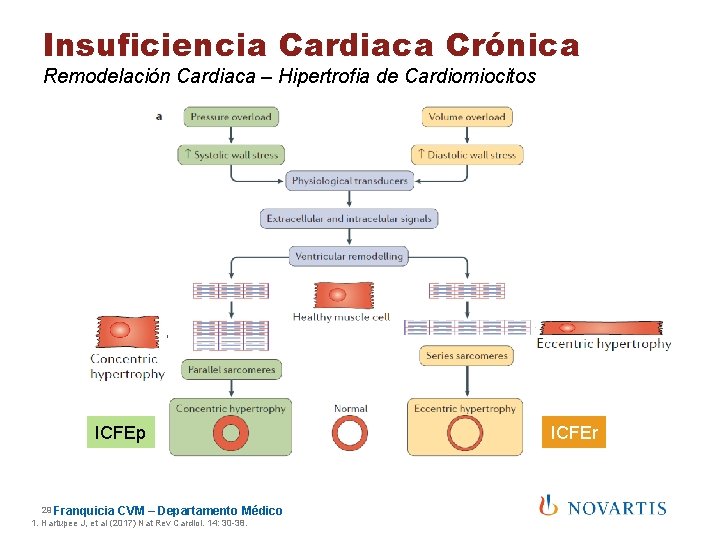 Insuficiencia Cardiaca Crónica Remodelación Cardiaca – Hipertrofia de Cardiomiocitos ICFEp 29 Franquicia CVM –