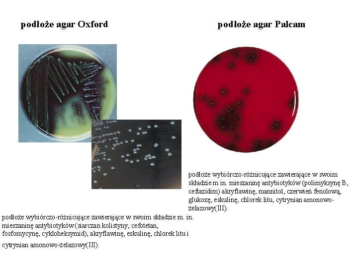 podłoże agar Oxford podłoże agar Palcam podłoże wybiórczo-różnicujące zawierające w swoim składzie m in.