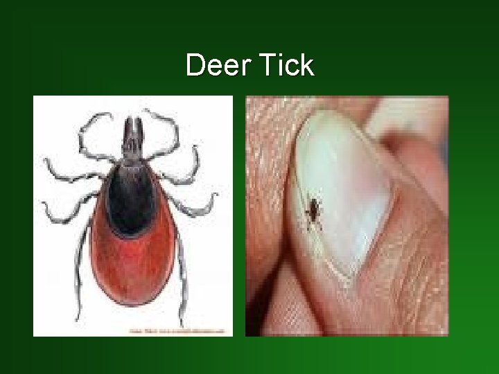 Deer Tick 