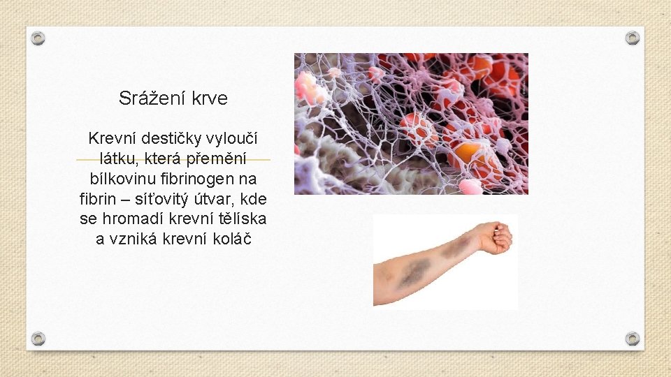 Srážení krve Krevní destičky vyloučí látku, která přemění bílkovinu fibrinogen na fibrin – síťovitý