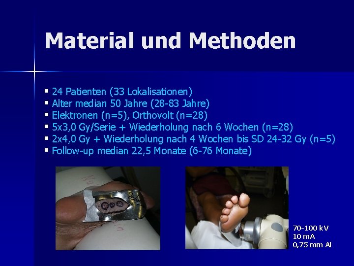 Material und Methoden § 24 Patienten (33 Lokalisationen) § Alter median 50 Jahre (28