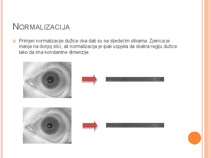 NORMALIZACIJA Primjeri normalizacije dužice oka dati su na sljedećim slikama. Zjenica je manja na