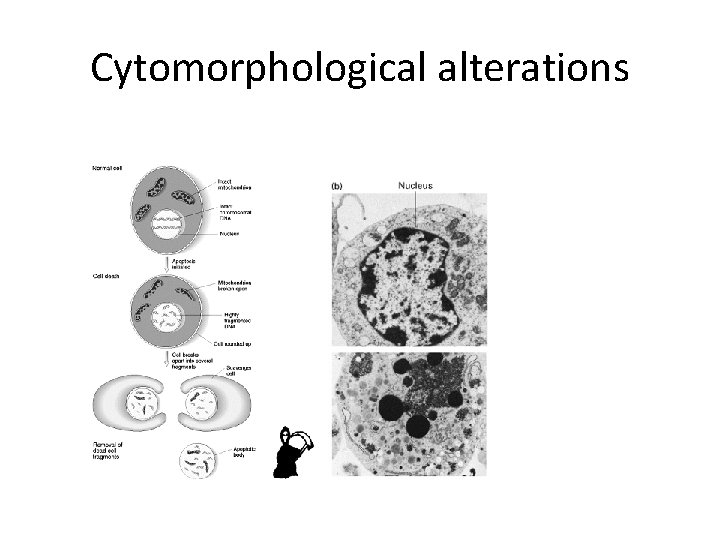 Cytomorphological alterations 