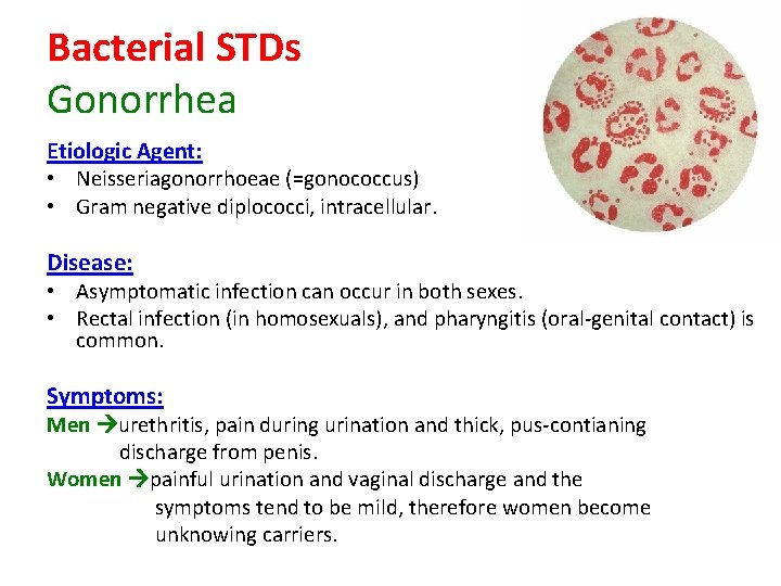 Bacterial STDs Gonorrhea Etiologic Agent: • Neisseriagonorrhoeae (=gonococcus) • Gram negative diplococci, intracellular. Disease: