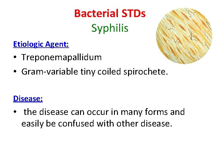 Bacterial STDs Syphilis Etiologic Agent: • Treponemapallidum • Gram-variable tiny coiled spirochete. Disease: •