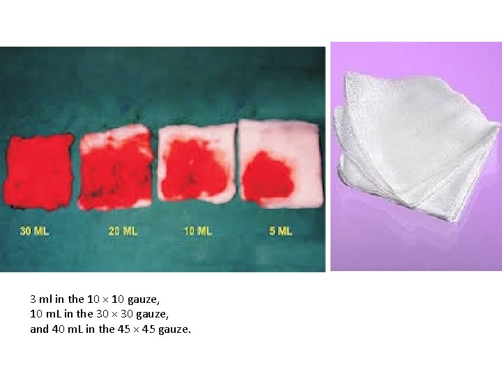 3 ml in the 10 × 10 gauze, 10 m. L in the 30