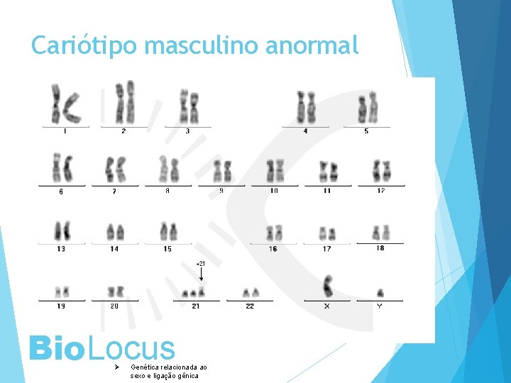 Cariótipo masculino anormal Bio. Locus Ø Genética relacionada ao sexo e ligação gênica 