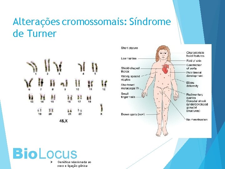 Alterações cromossomais: Síndrome de Turner Bio. Locus Ø Genética relacionada ao sexo e ligação