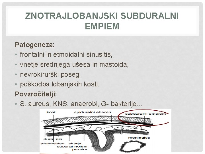 ZNOTRAJLOBANJSKI SUBDURALNI EMPIEM Patogeneza: • frontalni in etmoidalni sinusitis, • vnetje srednjega ušesa in