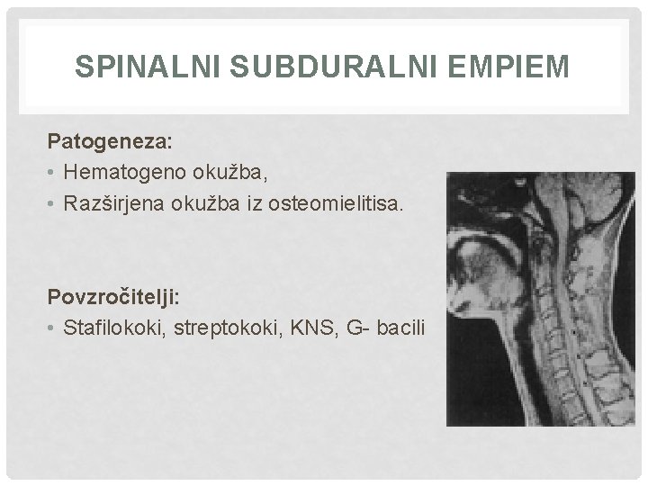 SPINALNI SUBDURALNI EMPIEM Patogeneza: • Hematogeno okužba, • Razširjena okužba iz osteomielitisa. Povzročitelji: •