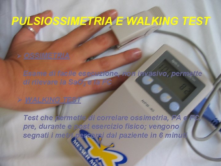 PULSIOSSIMETRIA E WALKING TEST Ø OSSIMETRIA Esame di facile esecuzione, non invasivo, permette di