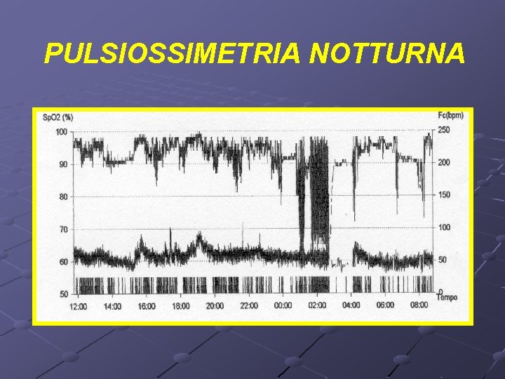 PULSIOSSIMETRIA NOTTURNA 