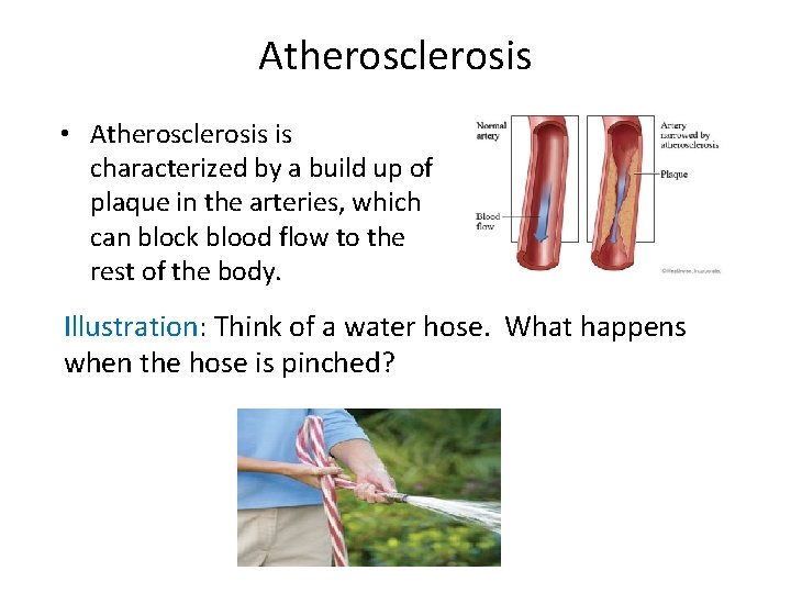 Atherosclerosis • Atherosclerosis is characterized by a build up of plaque in the arteries,