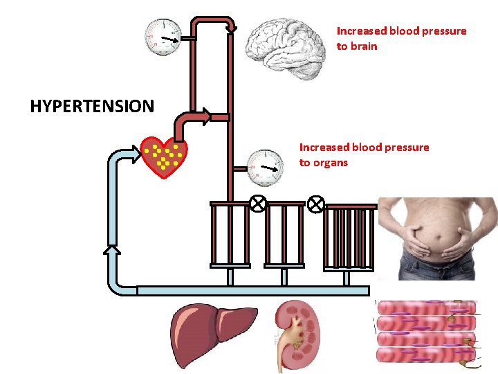 Increased blood pressure to brain HYPERTENSION Increased blood pressure to organs 