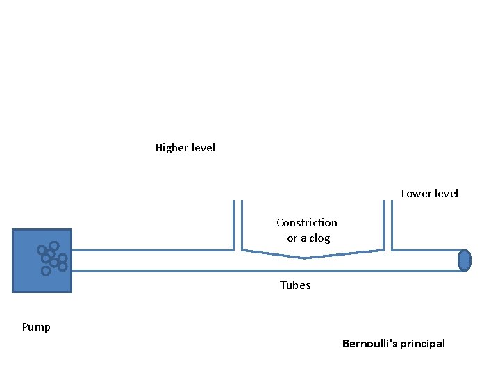 Higher level Lower level Constriction or a clog Tubes Pump Bernoulli's principal 