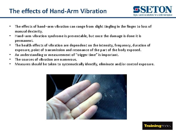 The effects of Hand-Arm Vibration • • • The effects of hand–arm vibration can