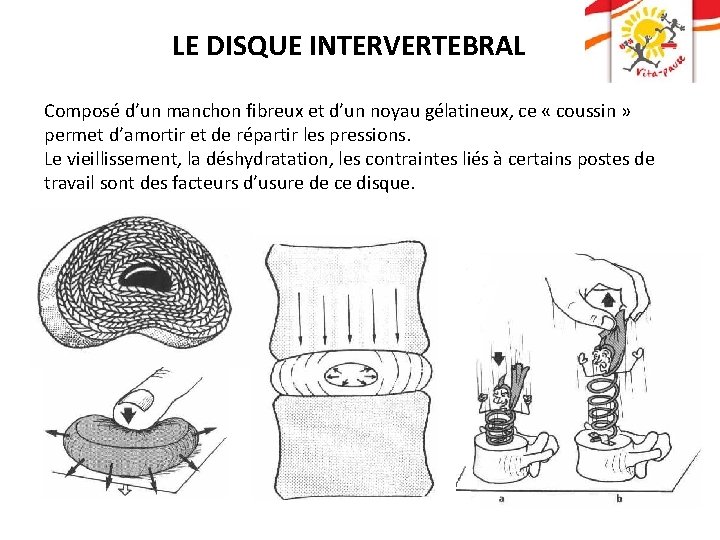 LE DISQUE INTERVERTEBRAL Composé d’un manchon fibreux et d’un noyau gélatineux, ce « coussin